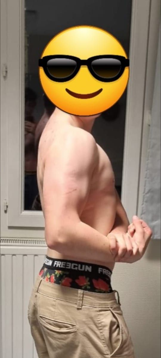 Profil de Ancel